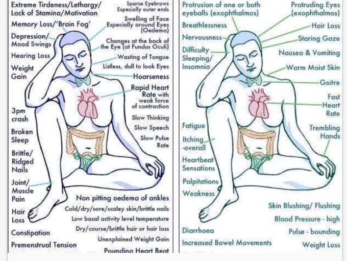 Hypothyroidism vs hyperthyroidism