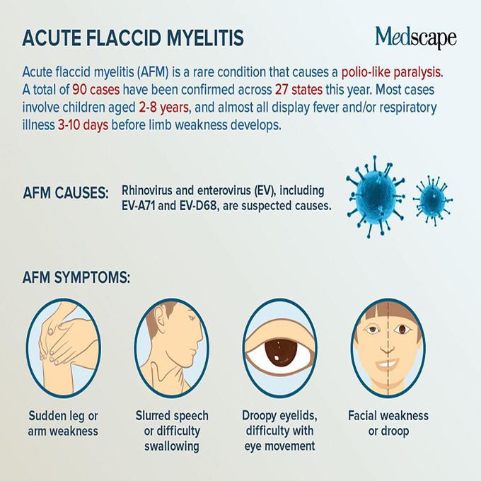 Acute flaccid myelitis, also known as AFM, is a rare condition that causes paralysis, characterized by sudden weakness or loss of muscle tone in the arms or legs.