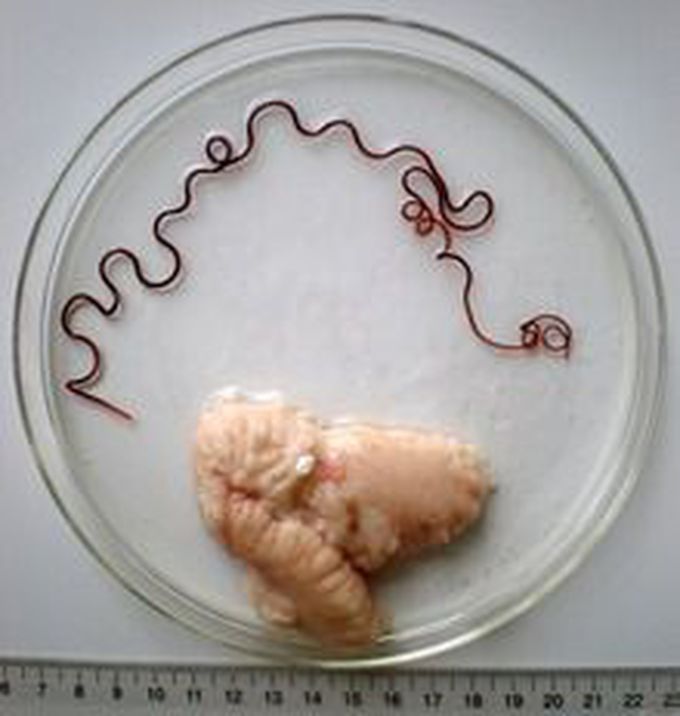 Ovary of a marine fish and its parasite