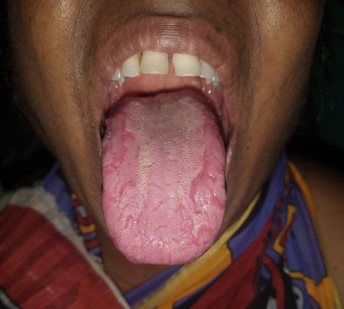 What is the name of Disease ?