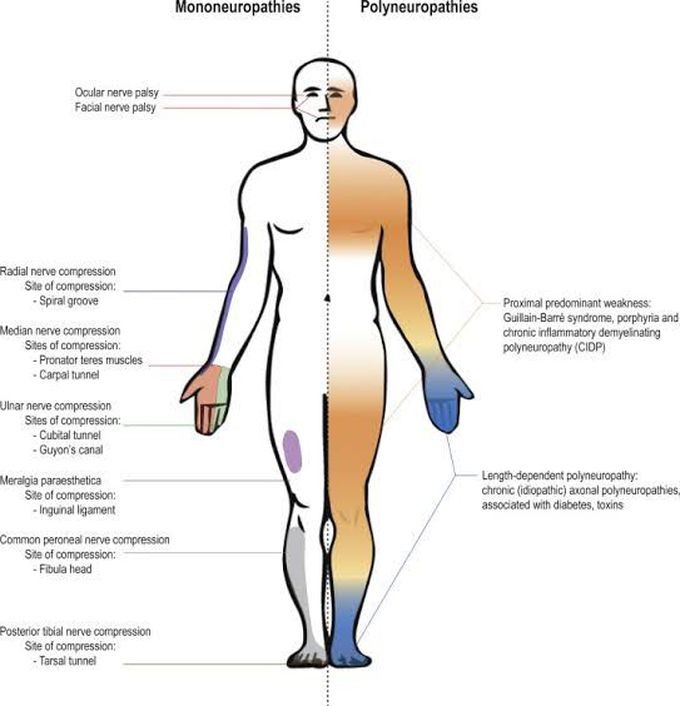 Peripheral neuropathies at a glance