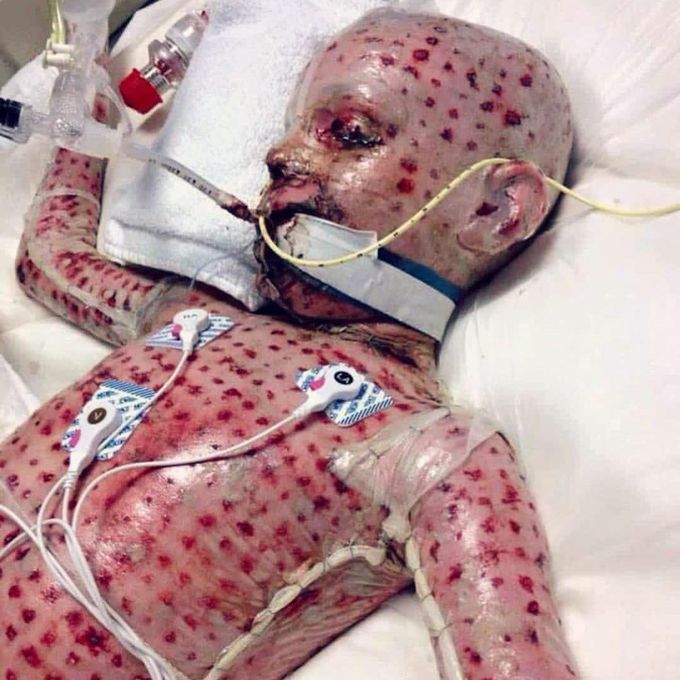 What is your diagnosis?