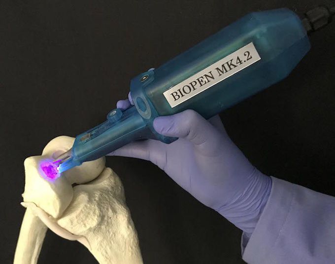 Handheld biopen prints human cartilage