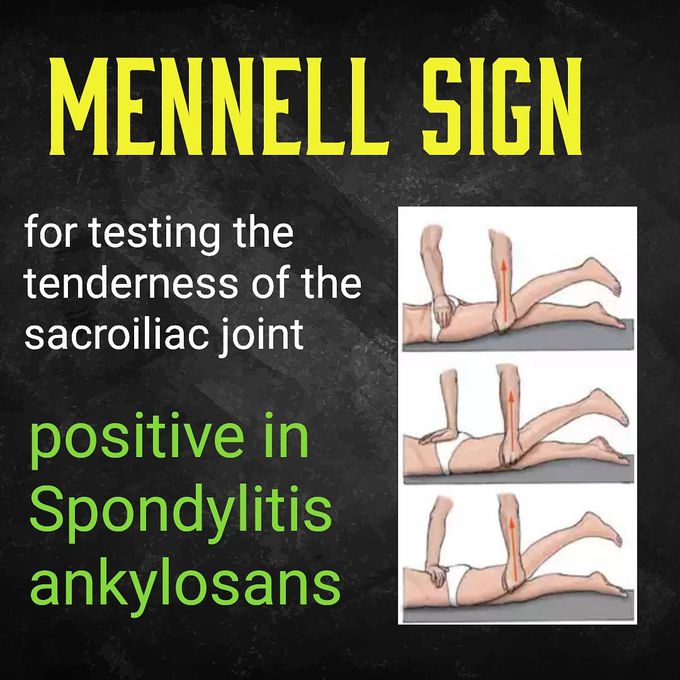 MENNELL sign