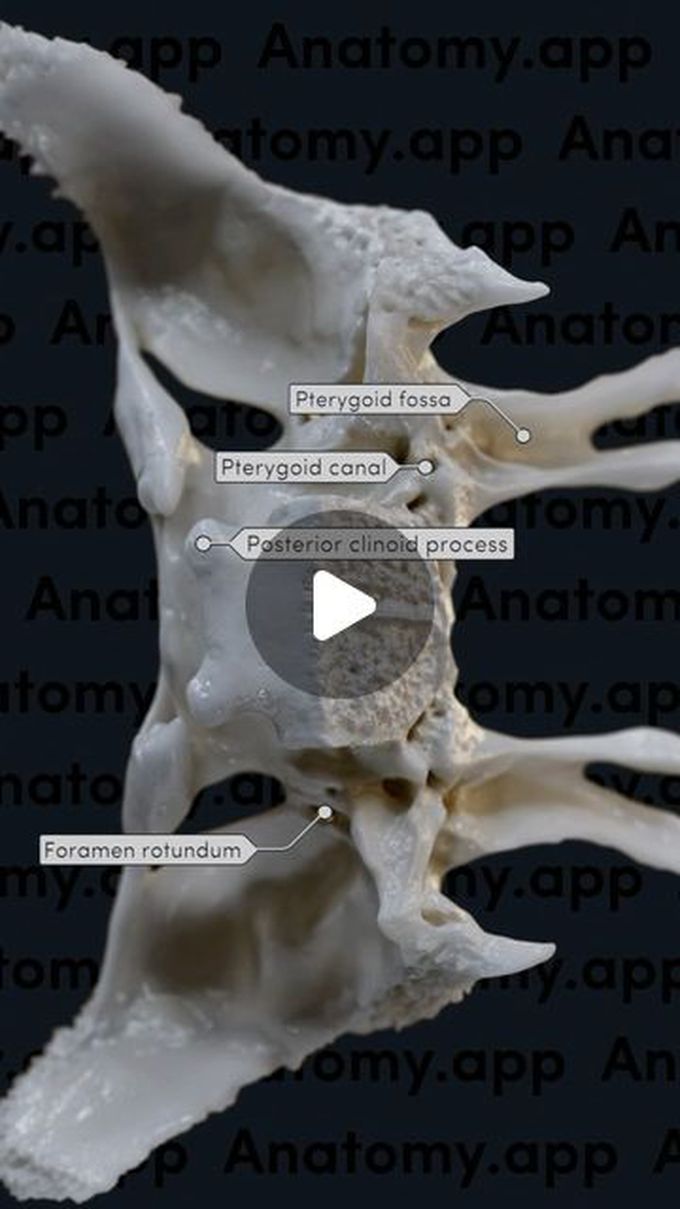 Sphenoid bone and its landmarks