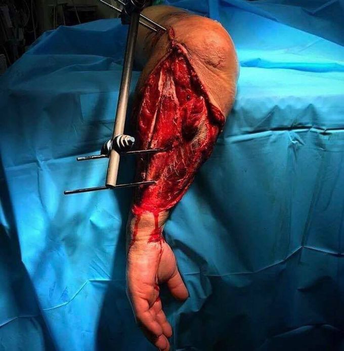 Esta imagen debe ser una advertencia para todos que conducen con su mano fuera de la ventana y las consecuencias que puede traer.