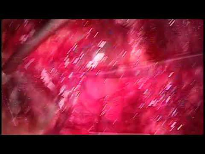 The Konno Procedure for a Redo Aortic Root Abscess