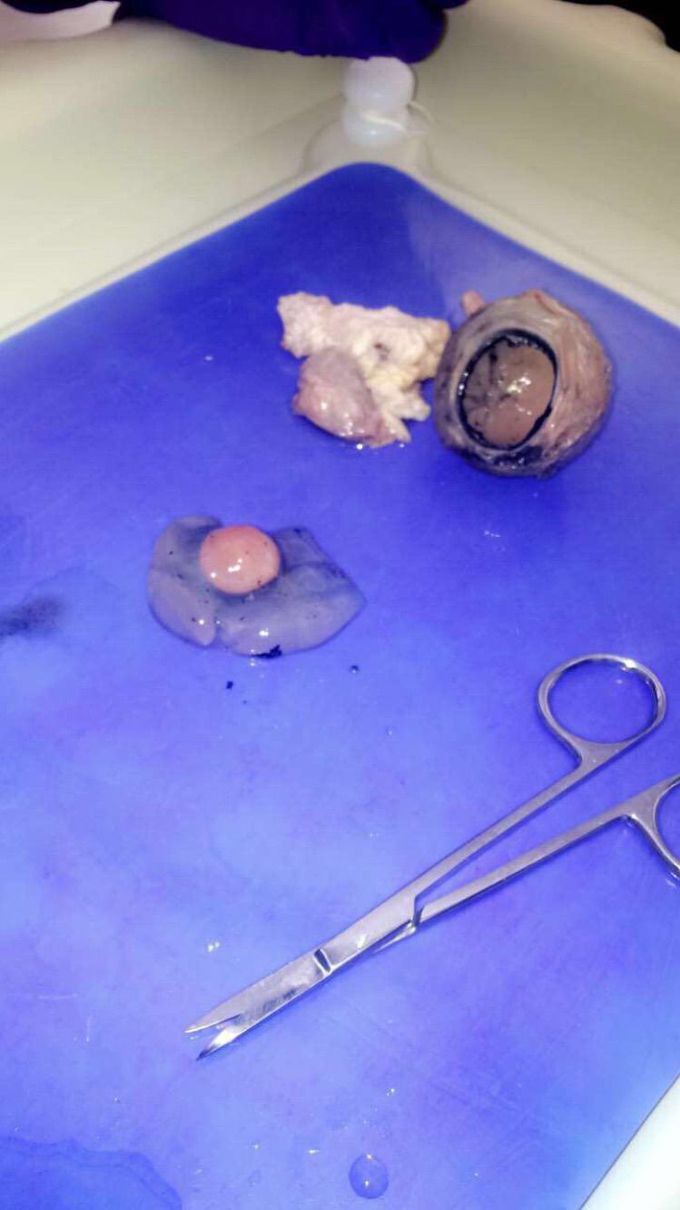 Eye dissection