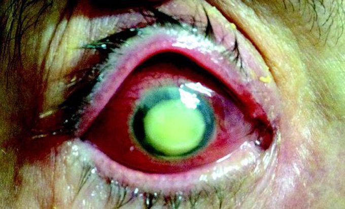What is your diagnosis?