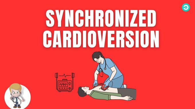 Synchronized Cardioversion procedure: Defibrillation in Action
