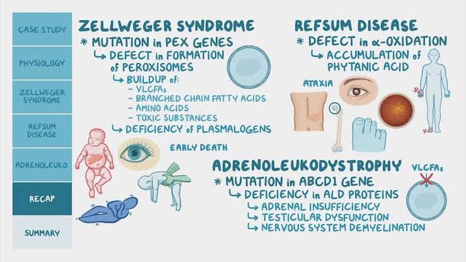 ZELLWEGER SYNDROME