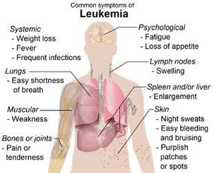 These are the symptoms of leukemia