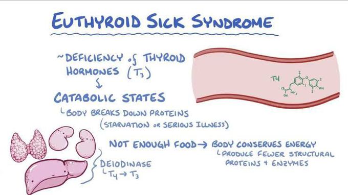 Sick euthyroidism