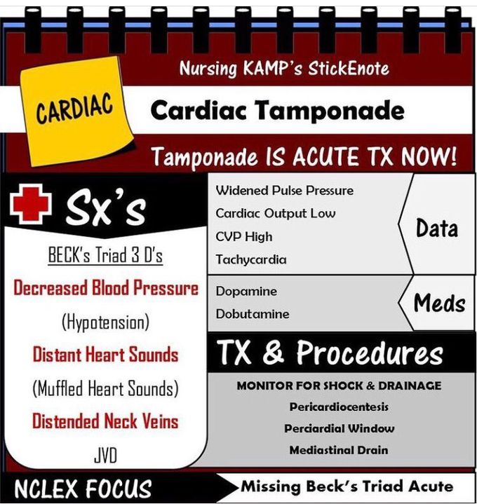 Cardiac Tamponade