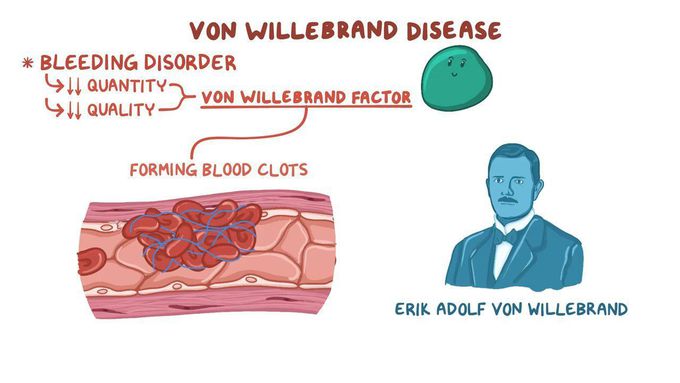 Von Willebrand disease.
