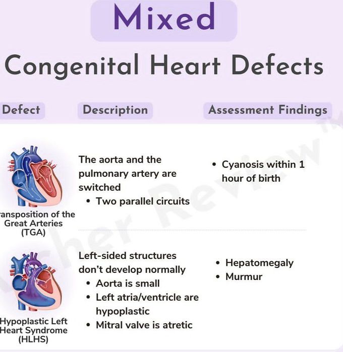 Mixed Congenital Heart Defect