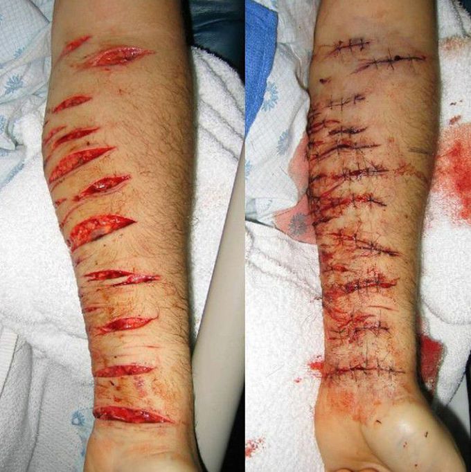 Suicide or homicide???