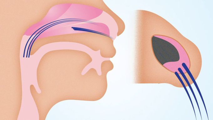 What causes Snoring?