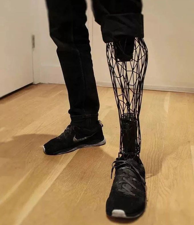 3D Printed Prosthetic