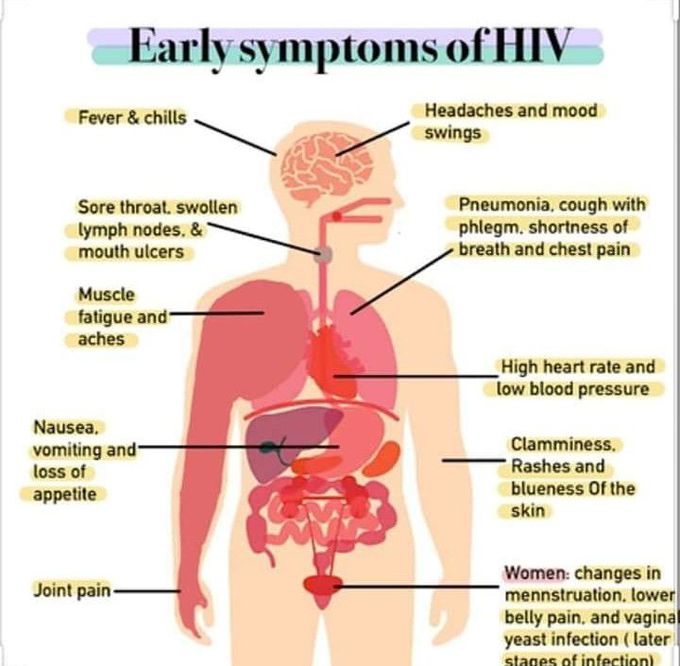 Symptoms of HIV