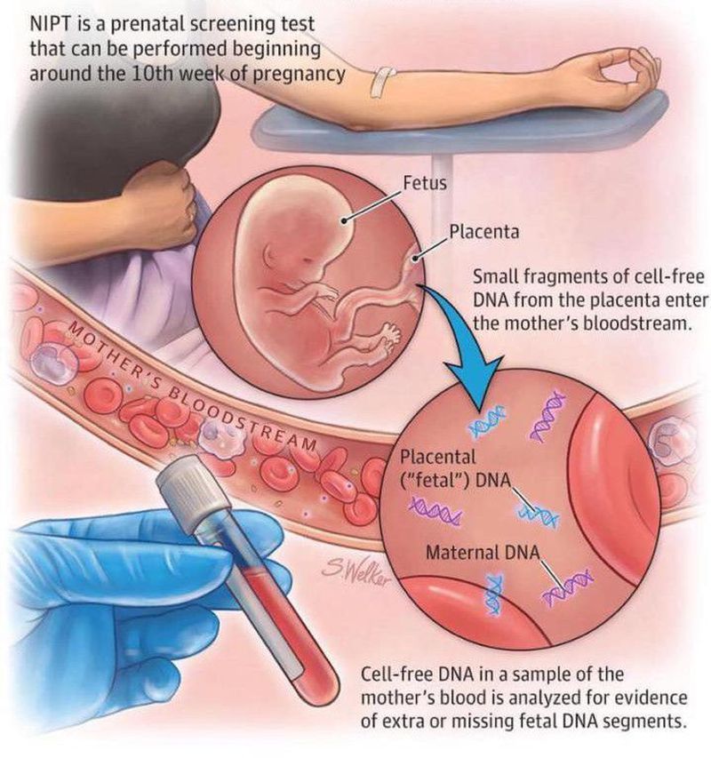 non-invasive-prenatal-screening-test-medizzy