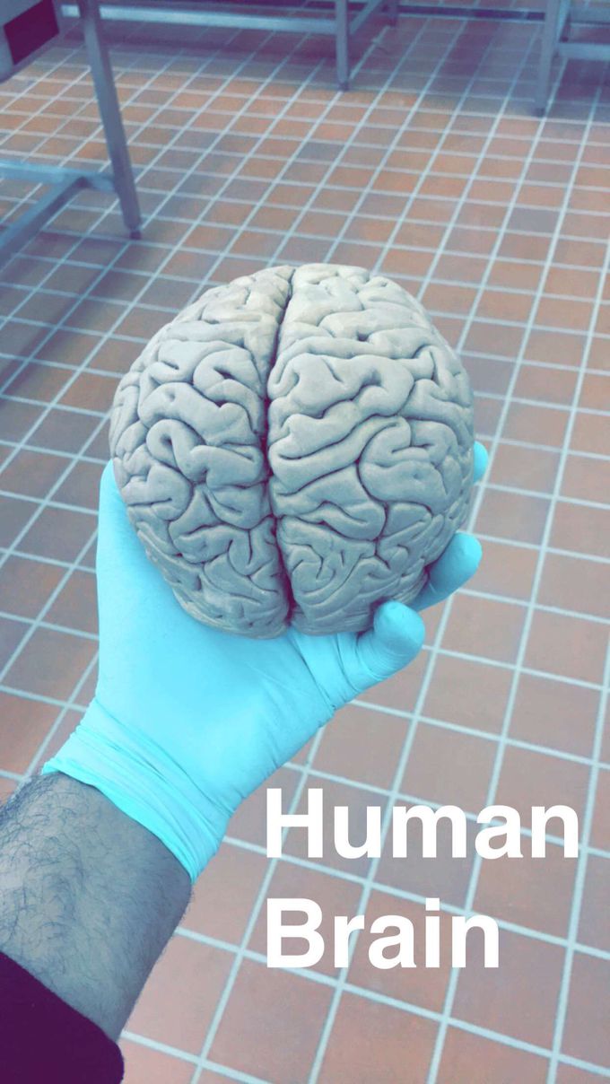 The brain
