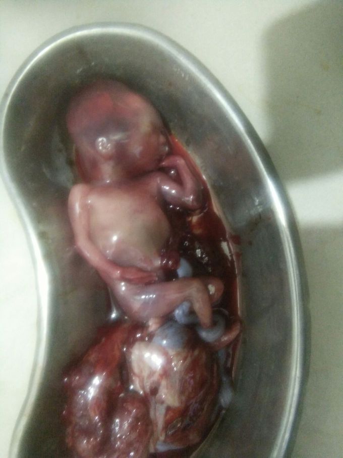 4 month dead male child