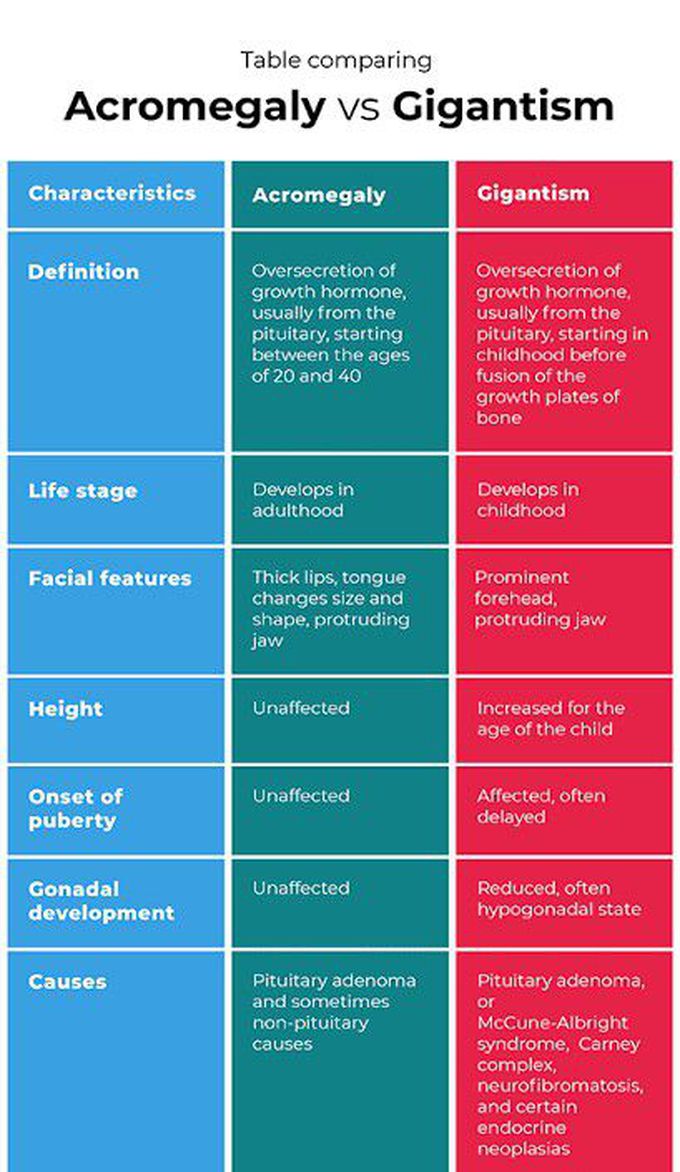 Acromegaly vs gigantism