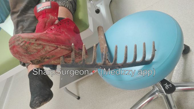Foot impaled on rake 😐