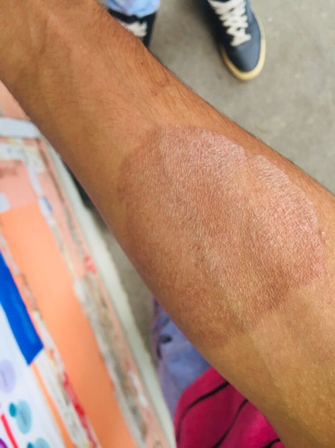 What’s your diagnosis???