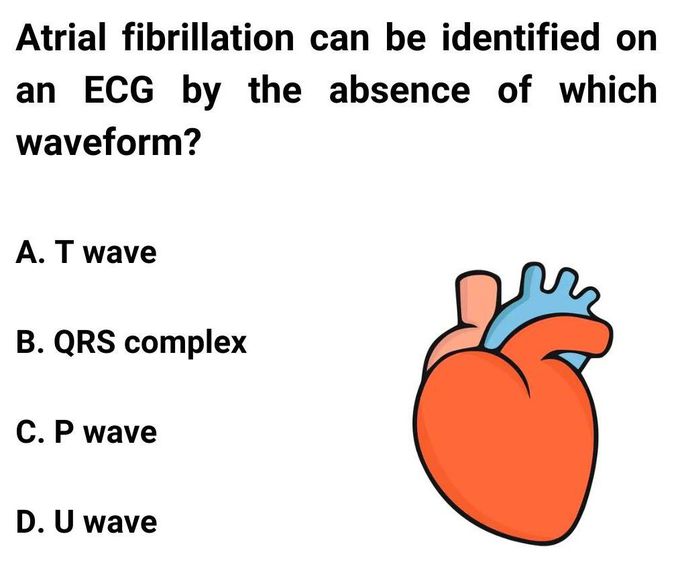 Atrial Fibrillation