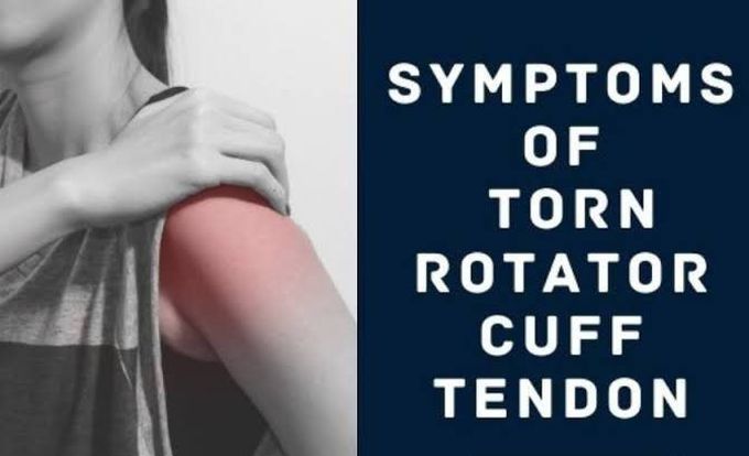 Symptoms of rotator cuff torn