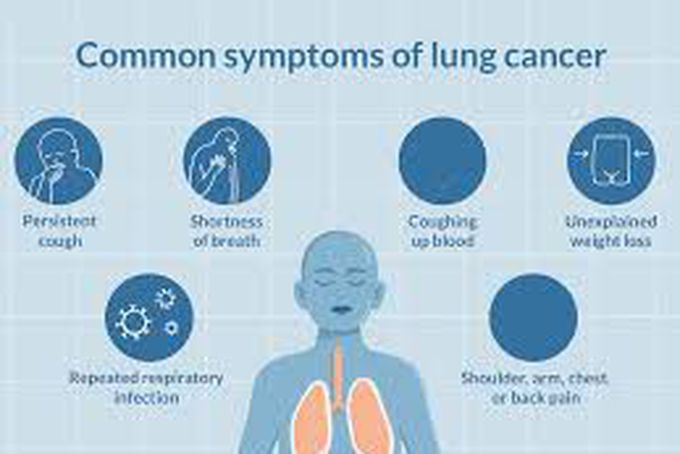 These are the symptoms of lung cancer