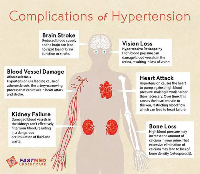 Hypertension