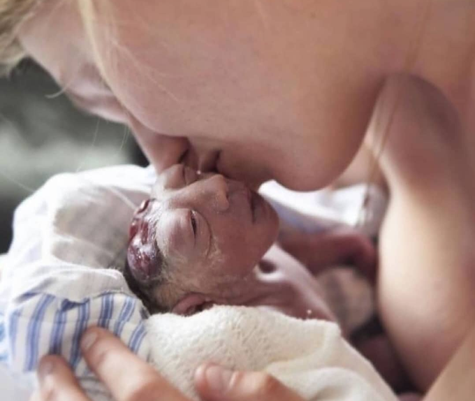 Baby born with encephalopathy but the love of mother is great 💝💝💝💝