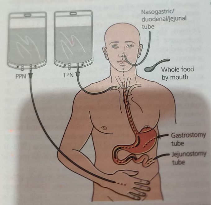 Different Modes of Nutrition