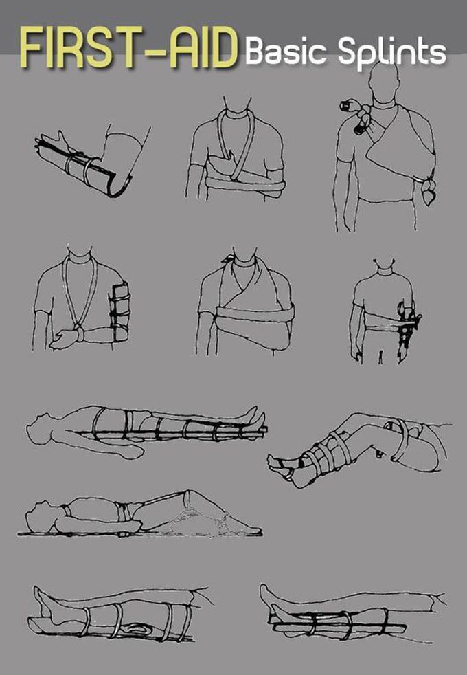 Basic splint first aid