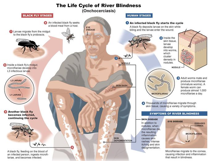 Cause of onchocerciasis