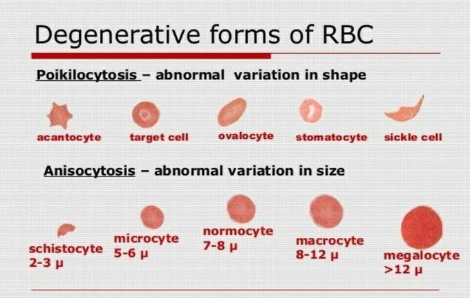 Degenerative Forms of RBC