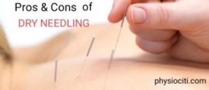 The Pros and Cons of Dry Needling