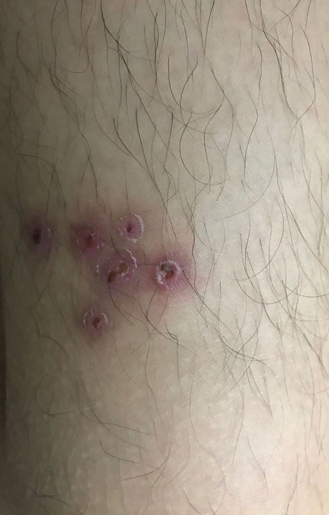 What diagnosis would you give?