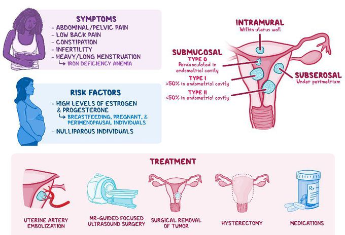 Cause of Uterine fibroids