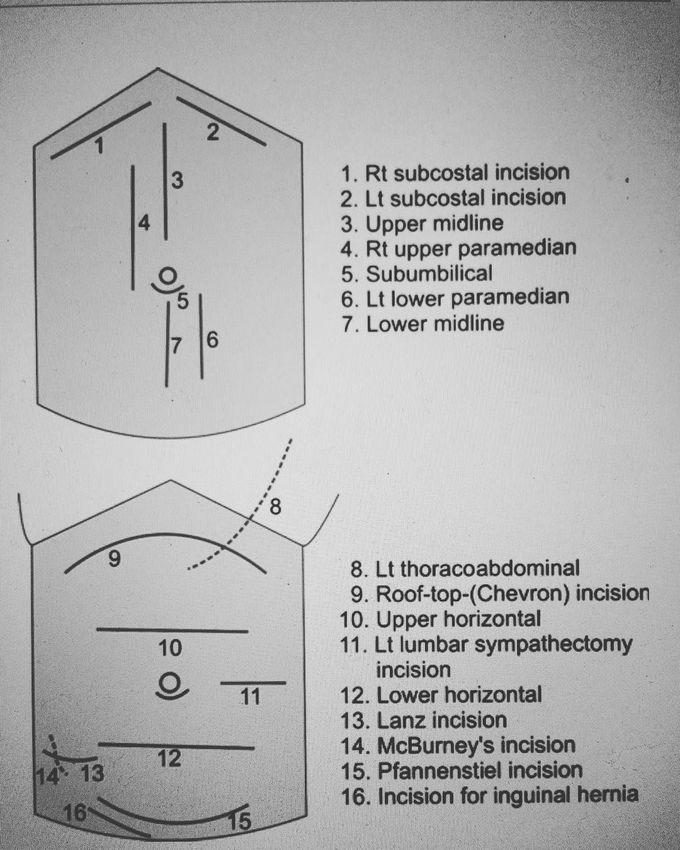 Various incisions in abdomen