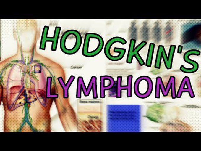 Basic knowledge of Hodgkin’s Lymphoma