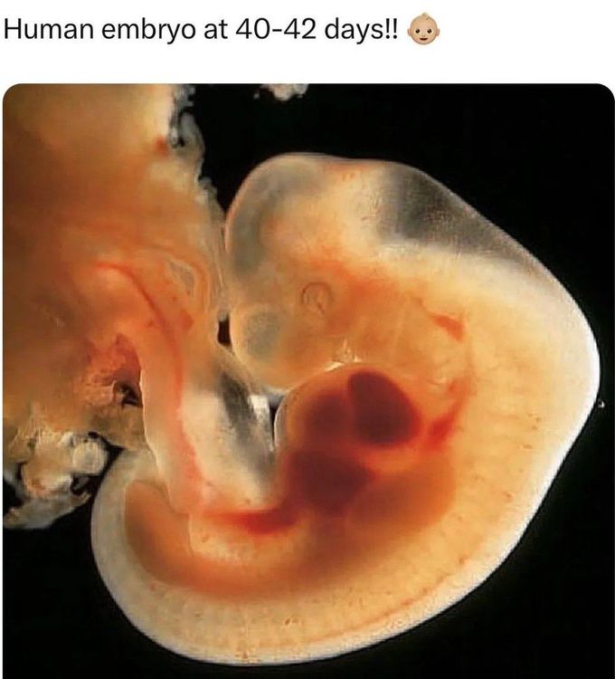 Human Embryo