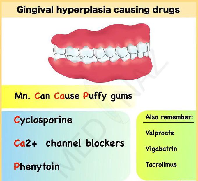 Gingival hyperplasia causing drugs medizzy