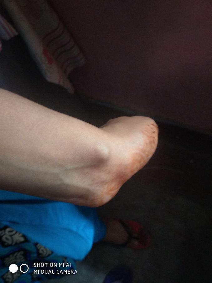 Ganglion