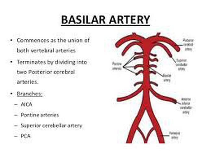 Basilar artery - MEDizzy