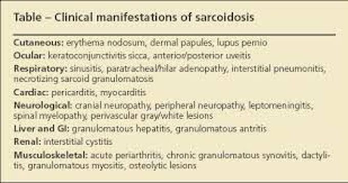 Sarcoidosis- Clinical Manifestation