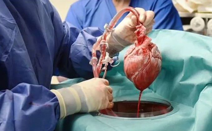 Man Who Received First Modified Pig Heart Transplant Dies